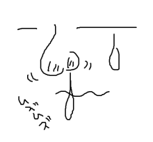 $EDS-ムズムズ